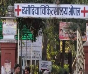 हमीदिया अस्पताल में मेडिकल चमत्कार, बिना सर्जरी 15 साल की इशरा को मिला नया जीवन