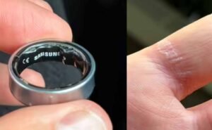 स्‍मार्ट रिंग बनी मुसीबत: एयरपोर्ट पर रोका गया यात्री, पहुंचा अस्‍पताल