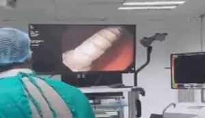 मौत के मुंह से लौटी 4 साल की अमायरा: आंत में फंसी थी 3 सेंटीमीटर लंबी कील, डॉक्टरों ने किया करिश्मा