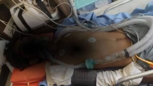 भिवाड़ी में पुलिस कस्टडी में नाबालिग से बर्बरता, हालत गंभीर, 4 पुलिसकर्मियों पर केस