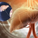 Fatty Liver को न करें नजरअंदाज! बढ़ सकता है हार्ट अटैक का खतरा, दिखें ये लक्षण तो तुरंत जाएं डॉक्टर के पास