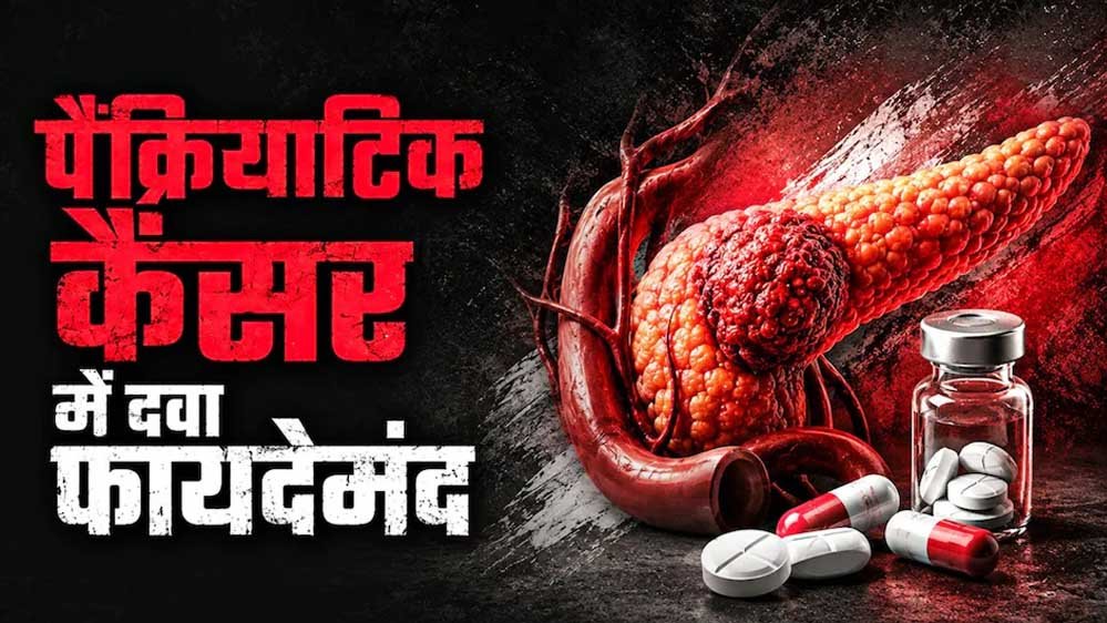 पैंक्रियाटिक कैंसर के इलाज में नई उम्मीद, FDA ने ‘रासोंक’ को दी मंजूरी; मौत का खतरा हुआ कम