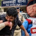 छतरपुर में रेप के आरोपी ने कांस्टेबल को काटा, मेडिकल जांच में HIV पॉजिटिव