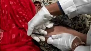 इंदौर MY अस्पताल में लाखों का बोटोक्स इलाज मुफ्त, लकवे के बाद जकड़े हाथ-पैरों में लौट रही हरकत